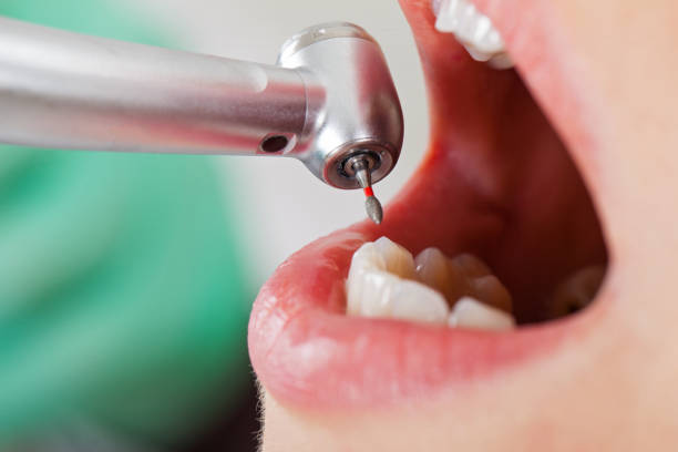Best Walk-In Emergency Dental Services in Arthurdale, WV
